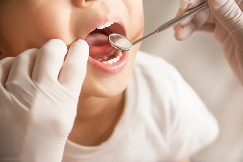 怖くない歯医者を目指す小児診療